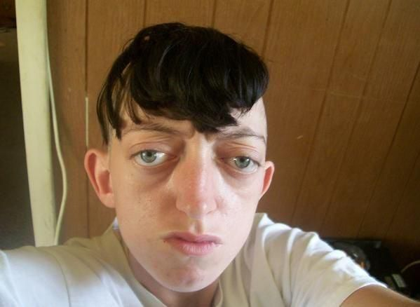 bugeyes, balding, no chin, awful ratios, subhuman.png